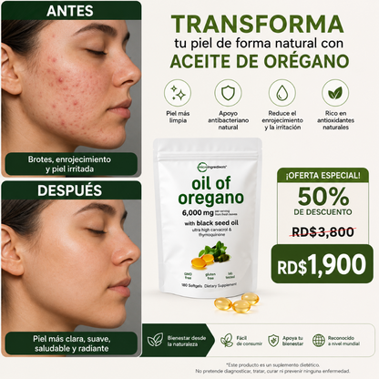 Aceite de Orégano - CÁPSULAS